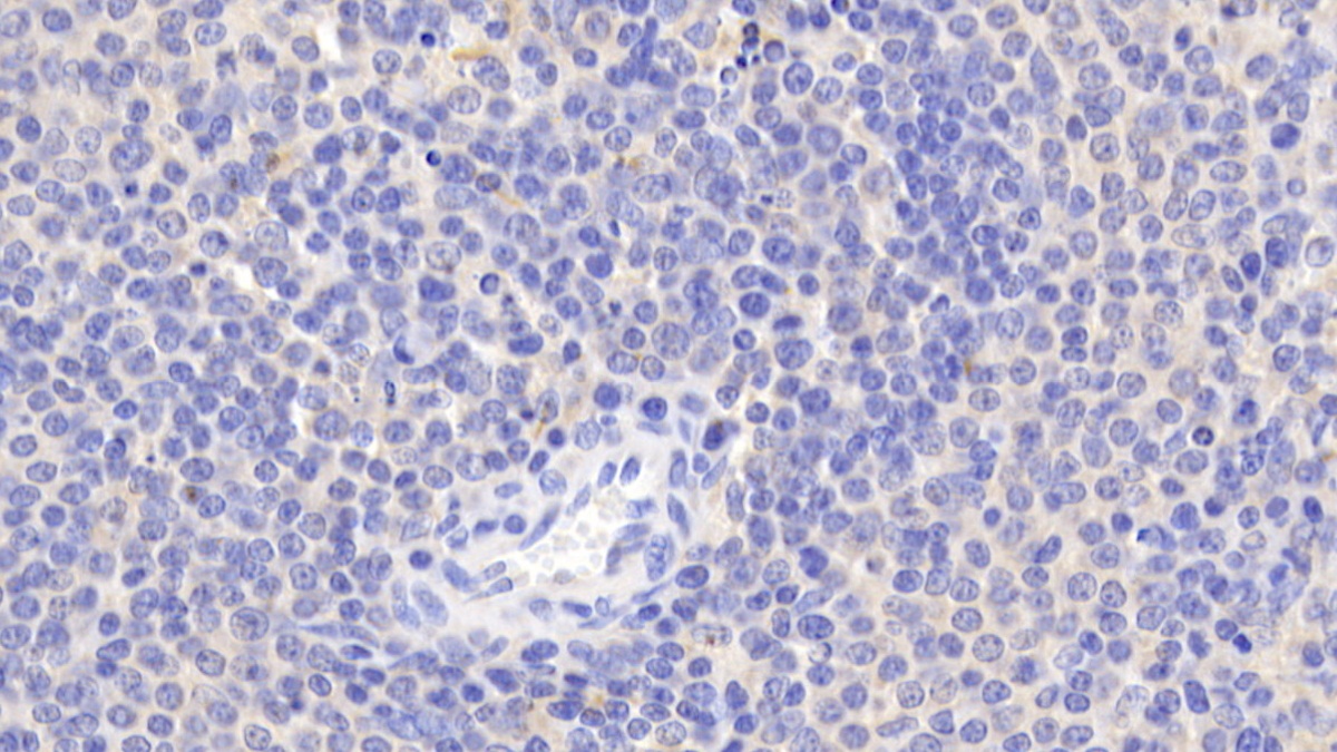 Polyclonal Antibody to BH3 Interacting Domain Death Agonist (Bid)