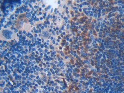 Polyclonal Antibody to BH3 Interacting Domain Death Agonist (Bid)