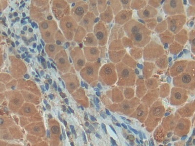 Polyclonal Antibody to Platelet Derived Growth Factor BB (PDGF BB)