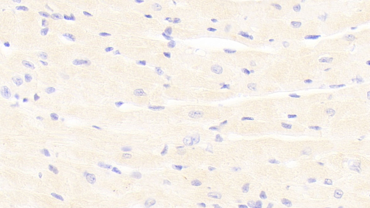 Polyclonal Antibody to Platelet Derived Growth Factor BB (PDGF BB)