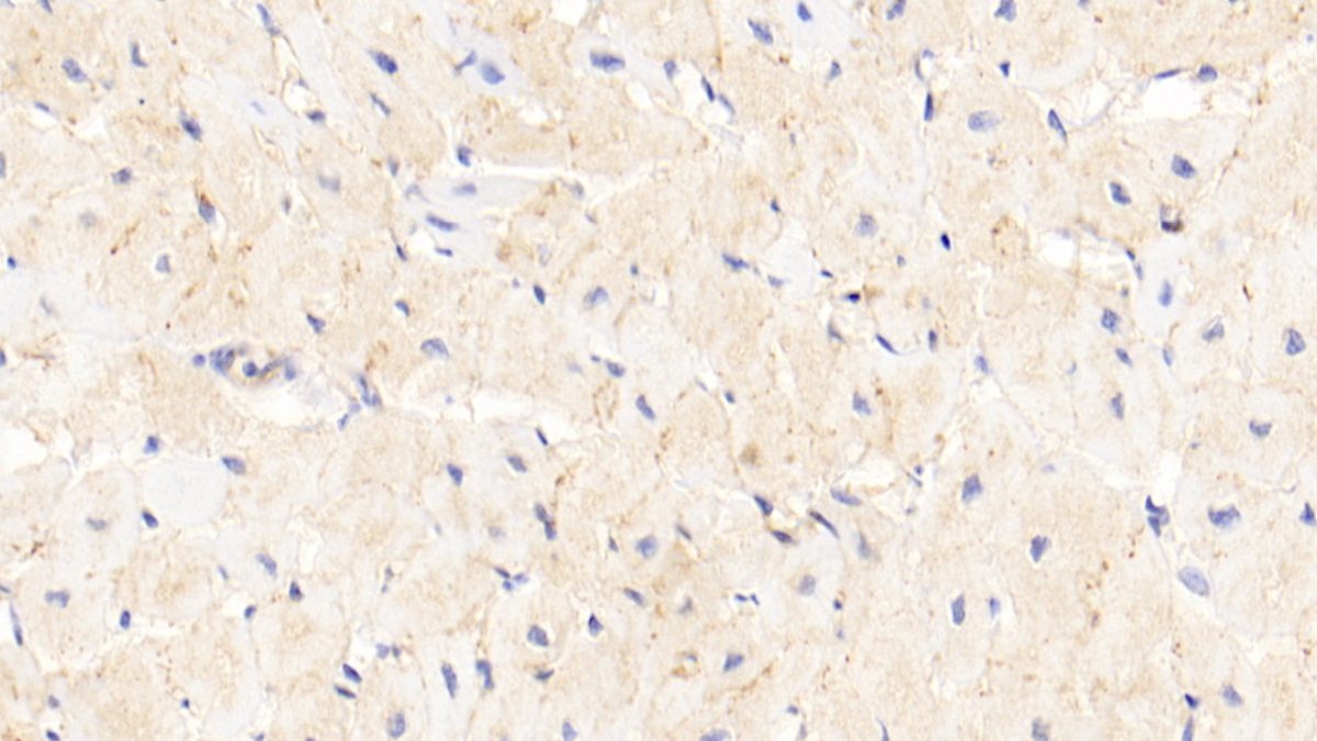 Polyclonal Antibody to Receptor For Advanced Glycation Endproducts (RAGE)
