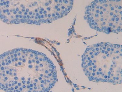 Polyclonal Antibody to Mothers Against Decapentaplegic Homolog 1 (Smad1)