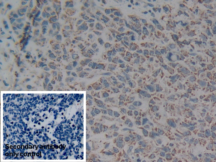 Polyclonal Antibody to Complement component 1 Q subcomponent-binding protein, mitochondrial (C1QBP)