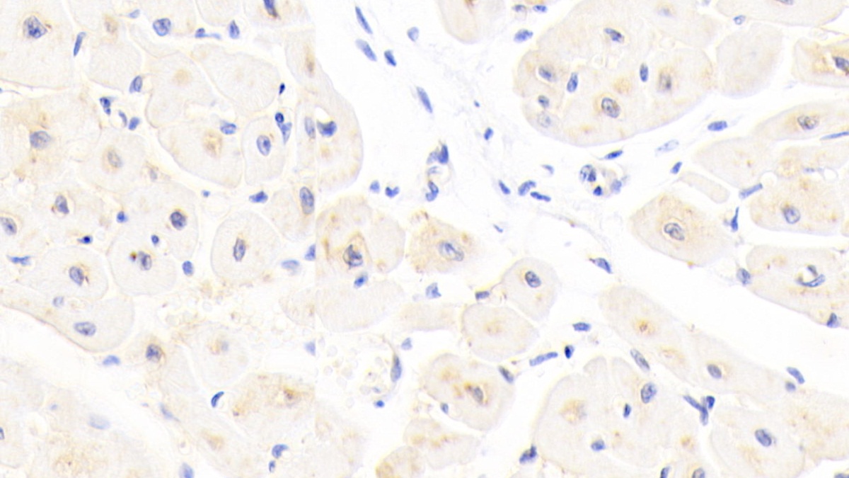 Polyclonal Antibody to Glutathione S Transferase A4 (GSTA4)