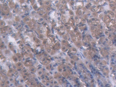 Polyclonal Antibody to Glucokinase (GCK)