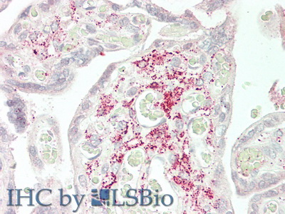 Polyclonal Antibody to Slit Homolog 2 (Slit2)