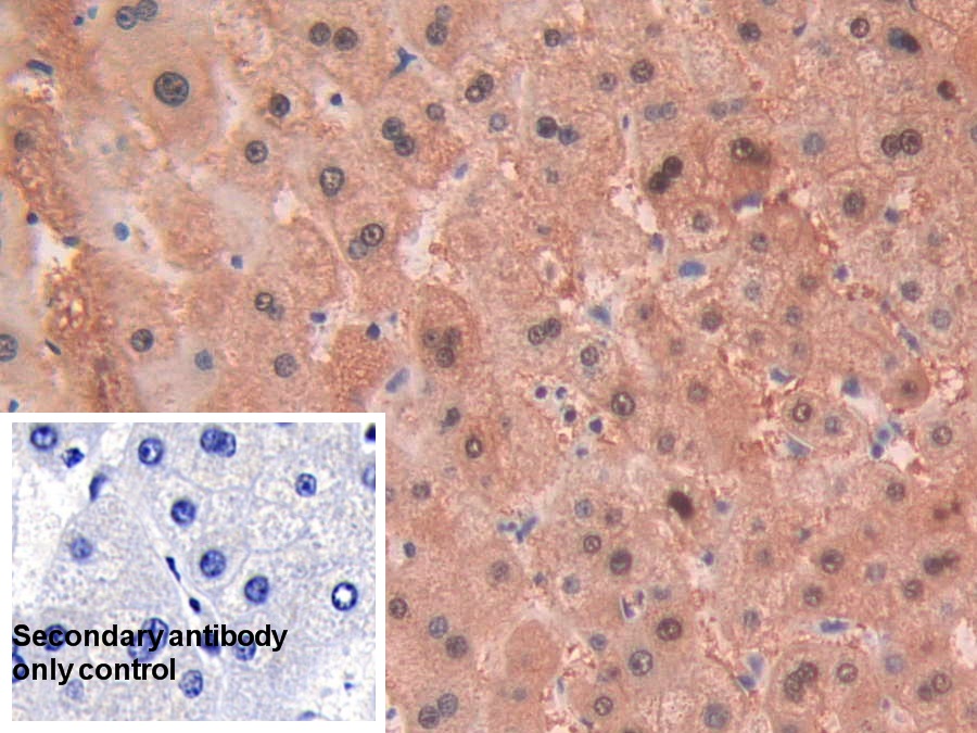 Polyclonal Antibody to Alcohol Dehydrogenase 1 (ADH1)