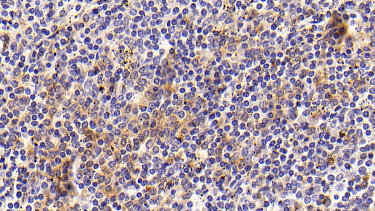 Polyclonal Antibody to Cluster Of Differentiation 14 (CD14)