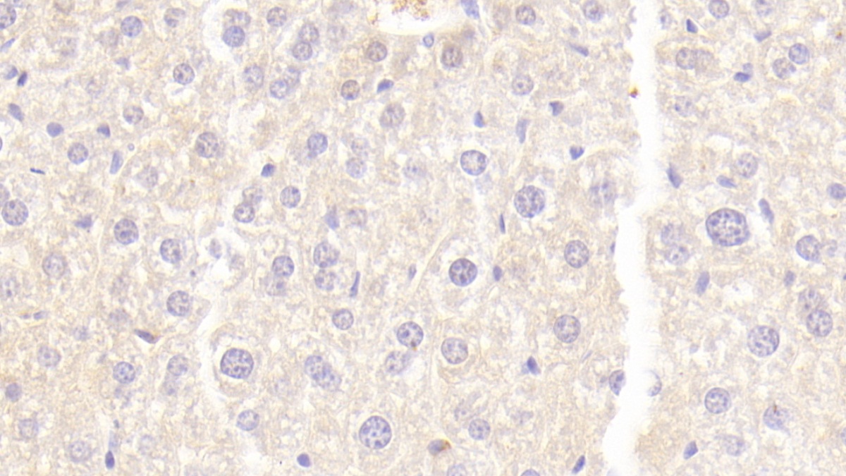 Polyclonal Antibody to Neuropilin 1 (NRP1)