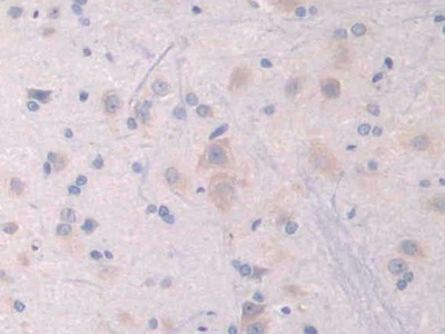 Polyclonal Antibody to Neuropilin 1 (NRP1)