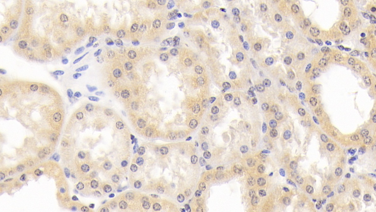 Polyclonal Antibody to Dihydrolipoyl Transacetylase (DLAT)