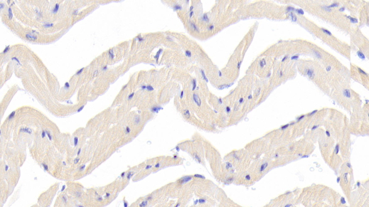 Polyclonal Antibody to Dihydrolipoyl Transacetylase (DLAT)