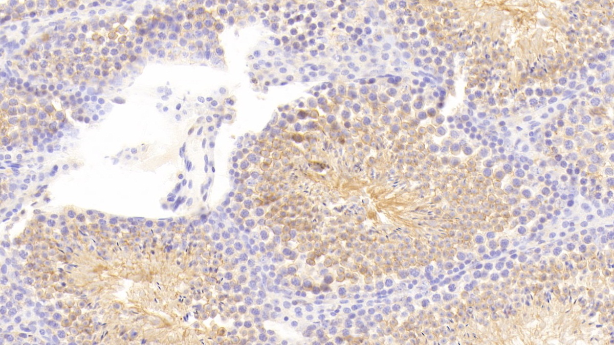 Polyclonal Antibody to Cyclooxygenase-2 (COX 2)