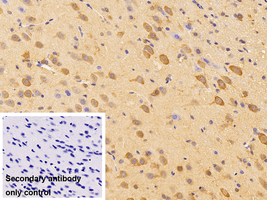 Polyclonal Antibody to Apolipoprotein E (APOE)