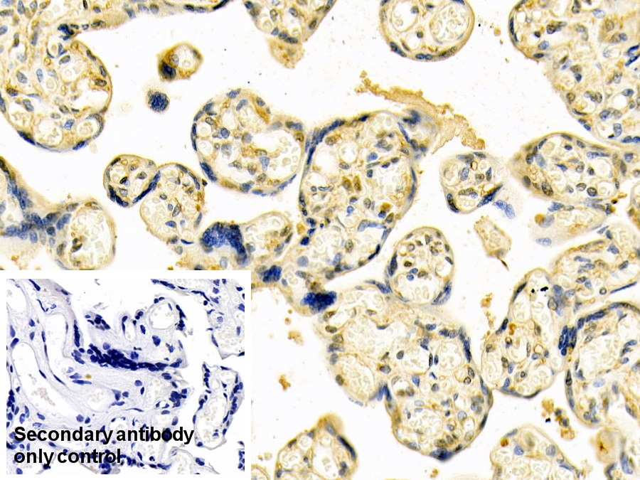 Polyclonal Antibody to Heparanase (HPSE)