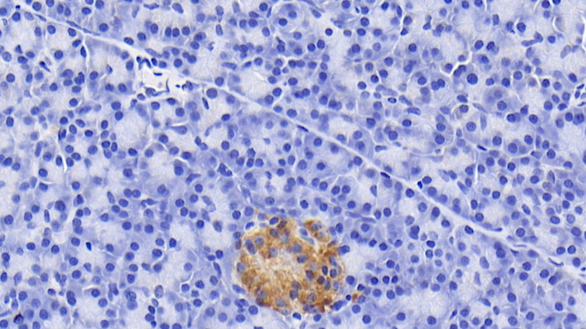 Polyclonal Antibody to Prealbumin (PALB)