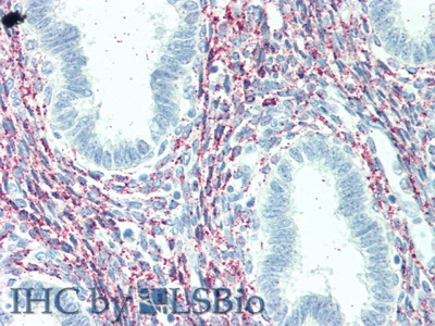 Polyclonal Antibody to Fibroblast Growth Factor 23 (FGF23)