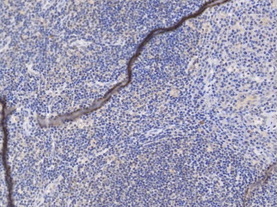 Polyclonal Antibody to Complement Receptor 2 (CD21)