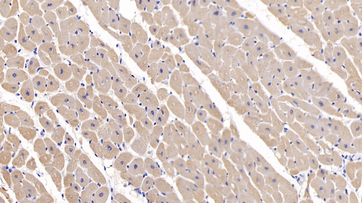 Polyclonal Antibody to Myosin Heavy Chain 2 (MYH2)