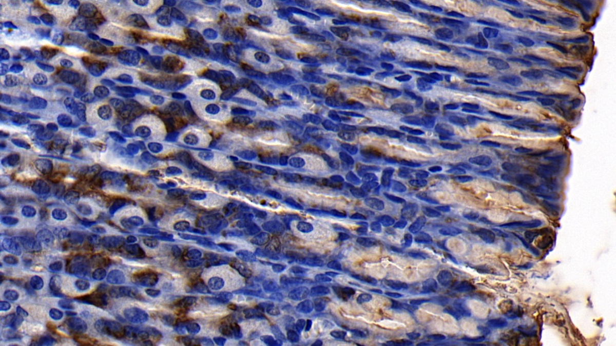 Polyclonal Antibody to Mucin 5 Subtype AC (MUC5AC)