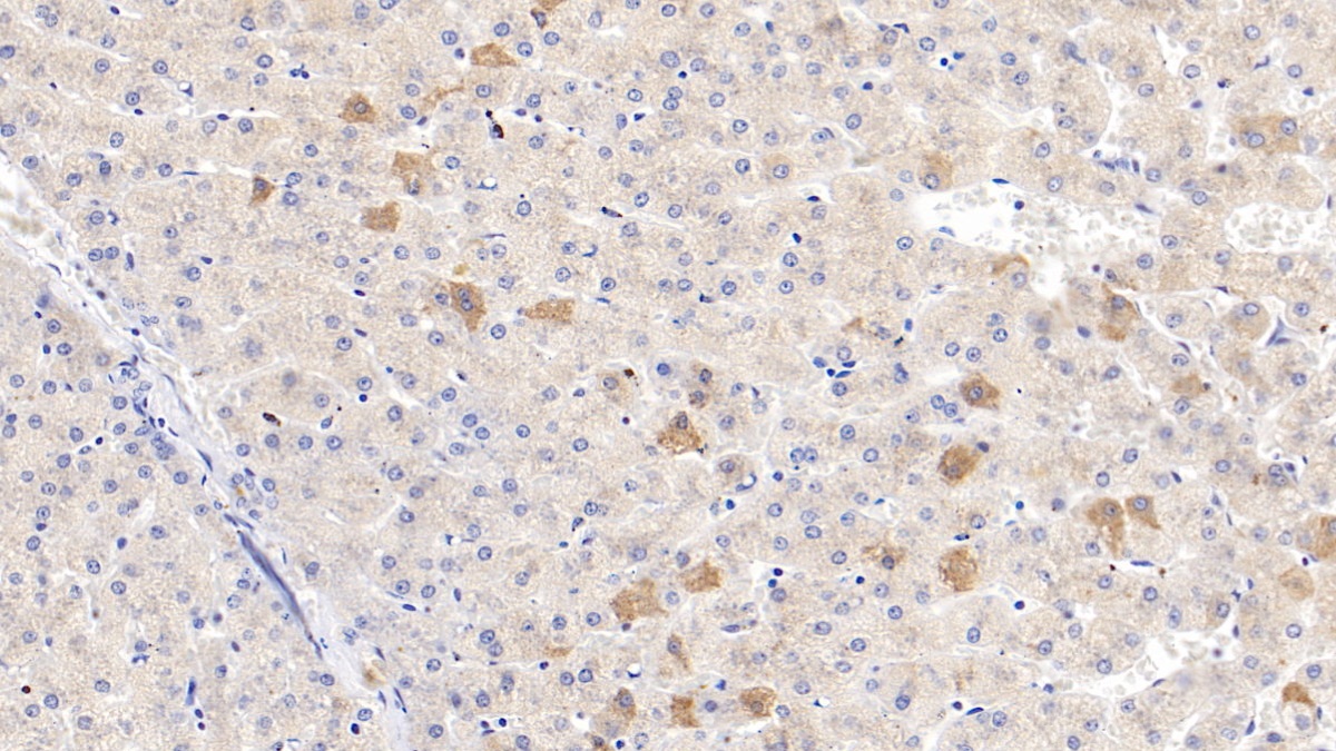 Polyclonal Antibody to C4 Binding Protein Beta (C4BPb)