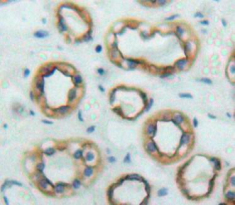 Polyclonal Antibody to Podocalyxin (PODXL)