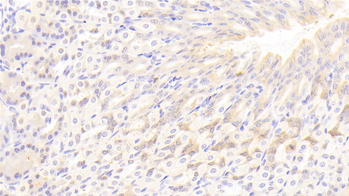 Polyclonal Antibody to Lipase, Hepatic (LIPC)