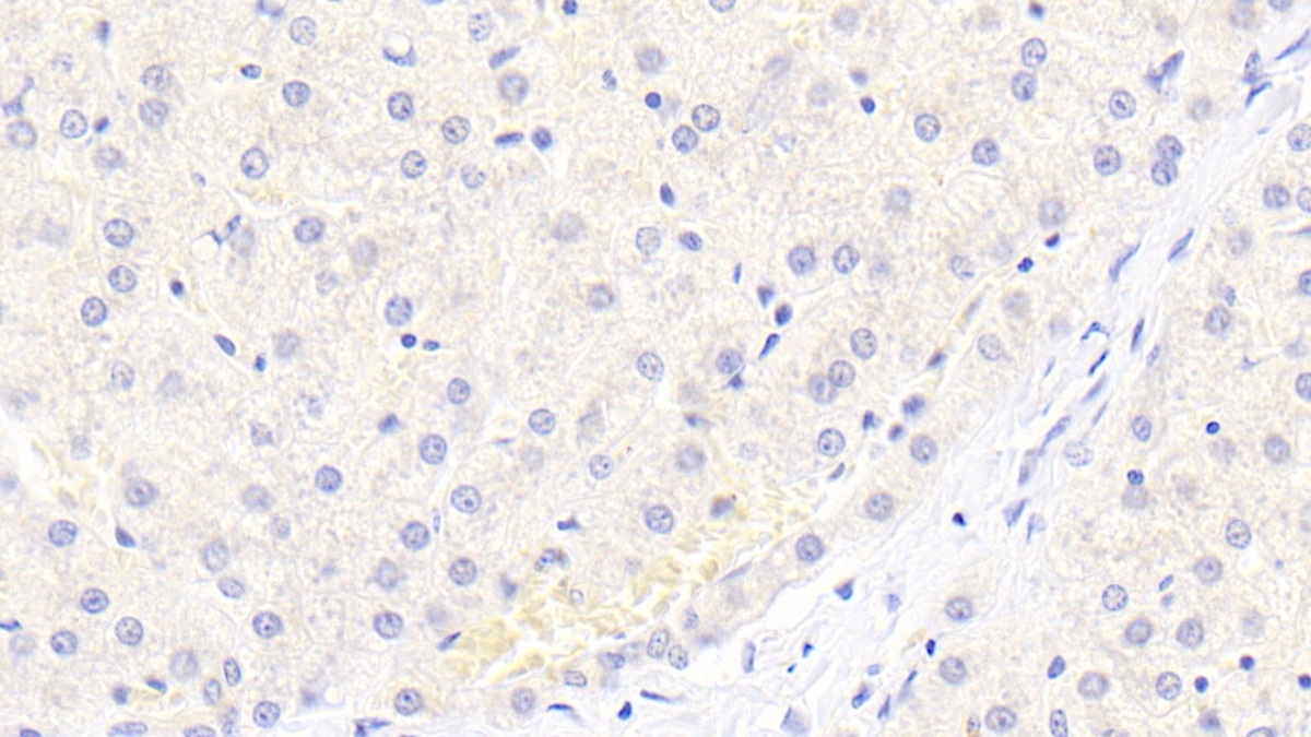 Polyclonal Antibody to Lipase, Hepatic (LIPC)
