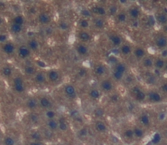 Polyclonal Antibody to Lipase, Hepatic (LIPC)