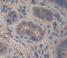 Polyclonal Antibody to Lactoferrin (LTF)