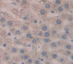 Polyclonal Antibody to Lactoferrin (LTF)