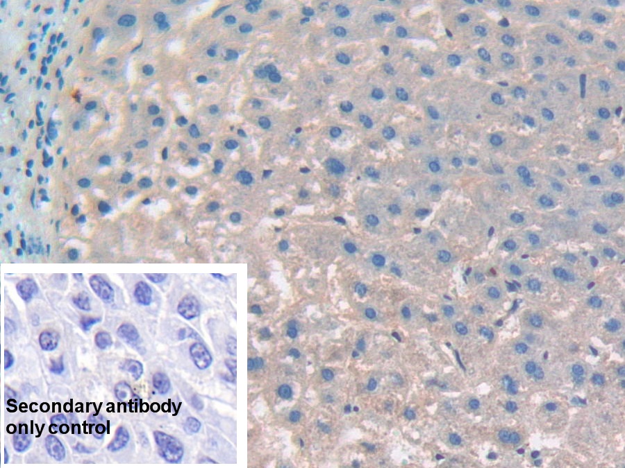 Polyclonal Antibody to Cluster Of Differentiation 276 (CD276)