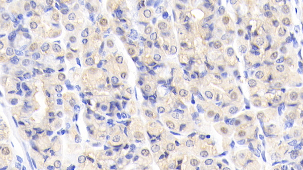 Polyclonal Antibody to Carbonic Anhydrase II (CA2)