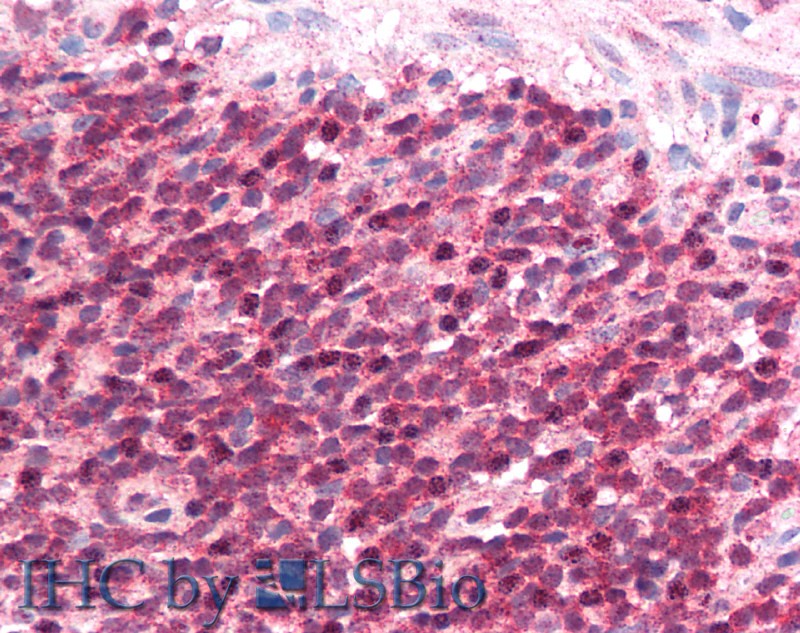 Polyclonal Antibody to Inducible T-Cell Co Stimulator Ligand (ICOSLG)