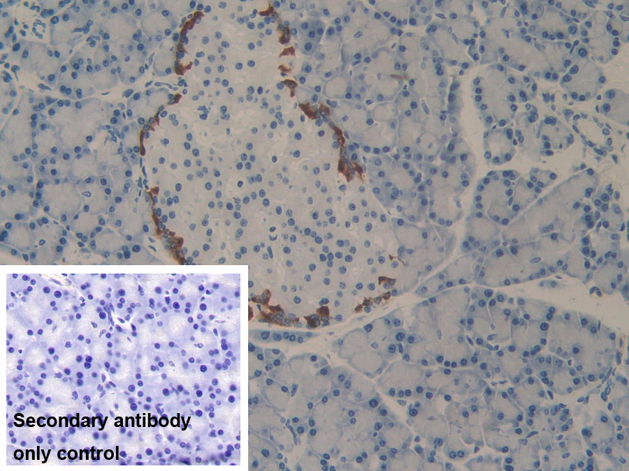 Polyclonal Antibody to Programmed Cell Death Protein 1 Ligand 2 (PDL2)