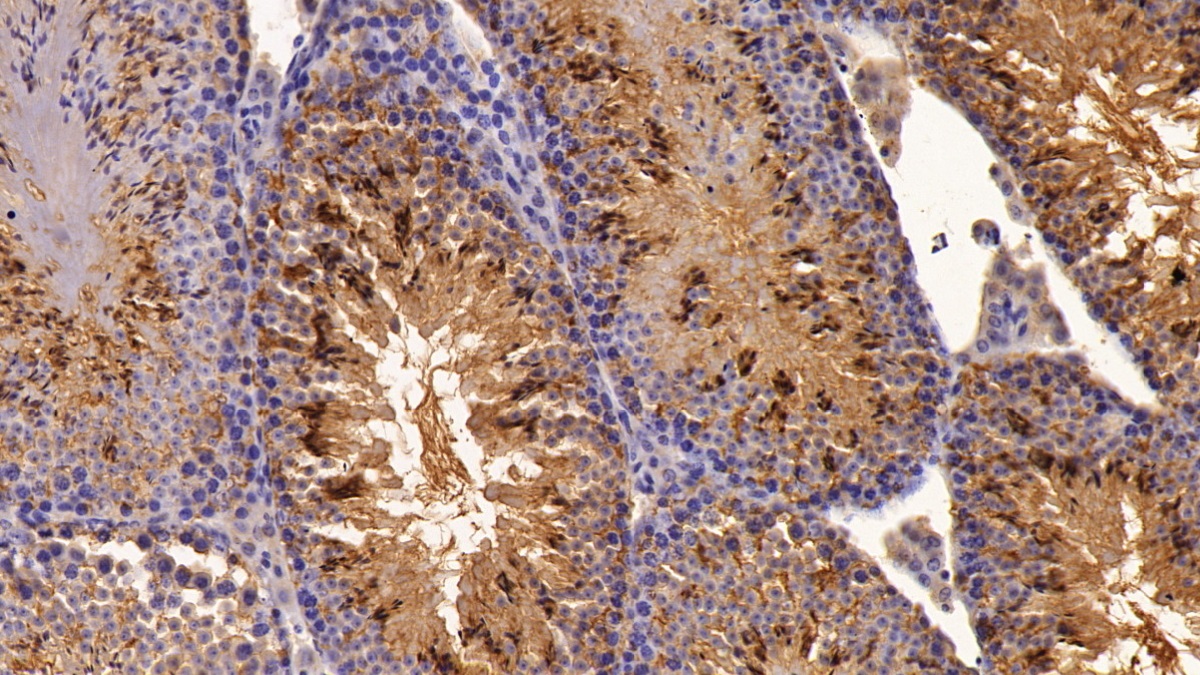 Polyclonal Antibody to Osteonectin (ON)