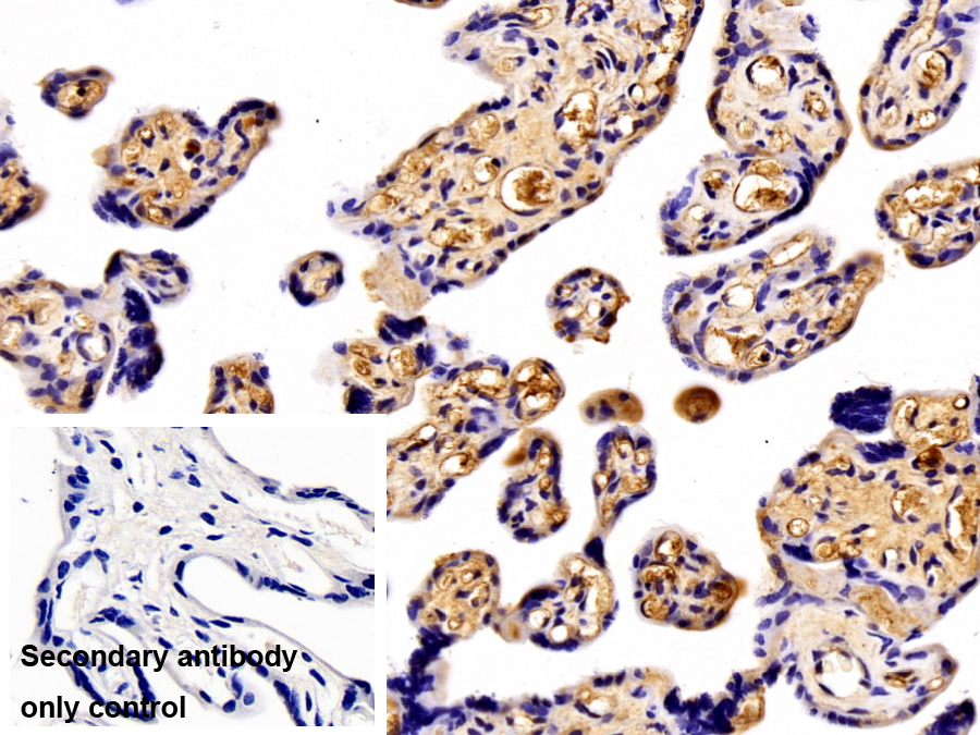 Polyclonal Antibody to Angiotensinogen (AGT)