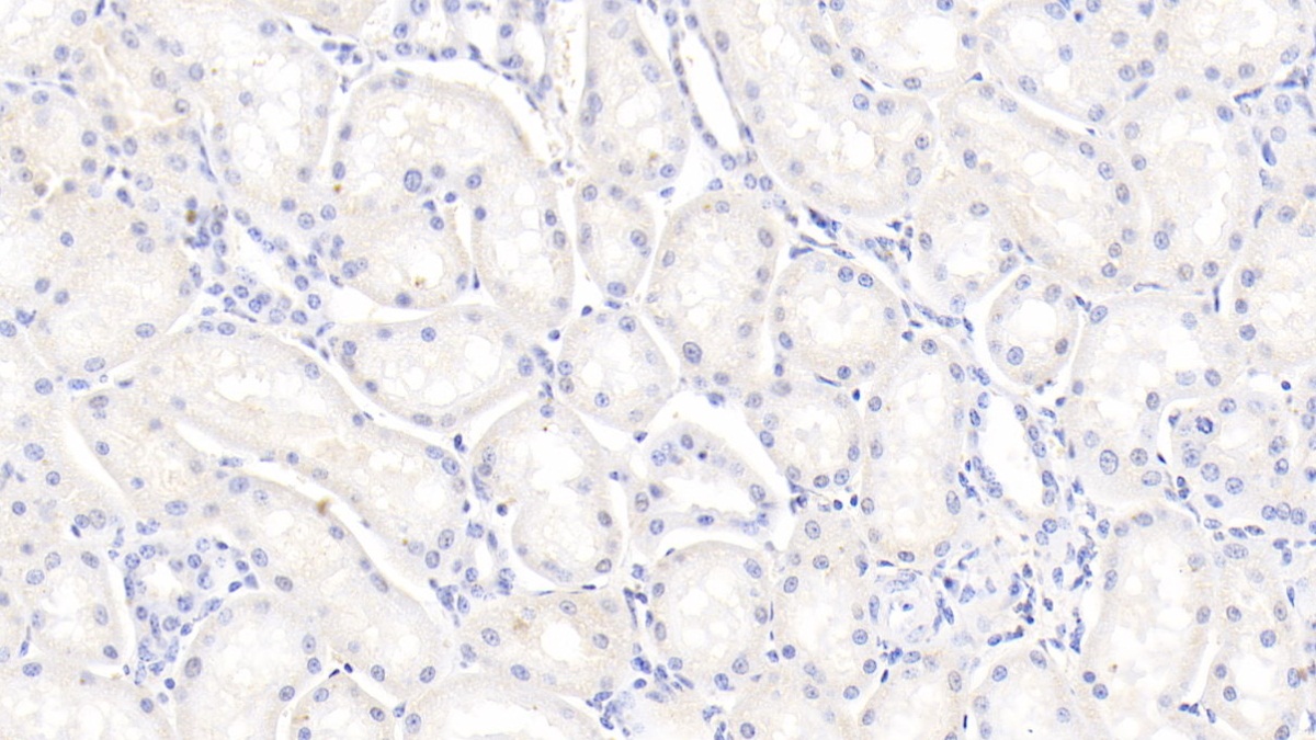 Polyclonal Antibody to Bone Morphogenetic Protein 7 (BMP7)