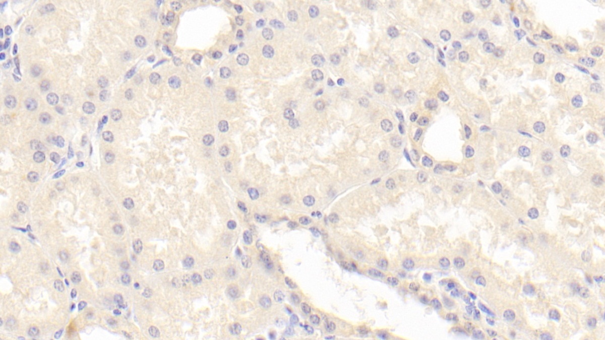 Polyclonal Antibody to Bone Morphogenetic Protein 7 (BMP7)