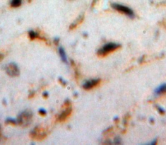 Polyclonal Antibody to Cardiotrophin 1 (CT1)