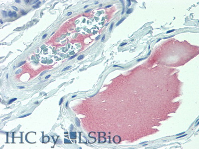 Polyclonal Antibody to Angiotensin I (AngI)