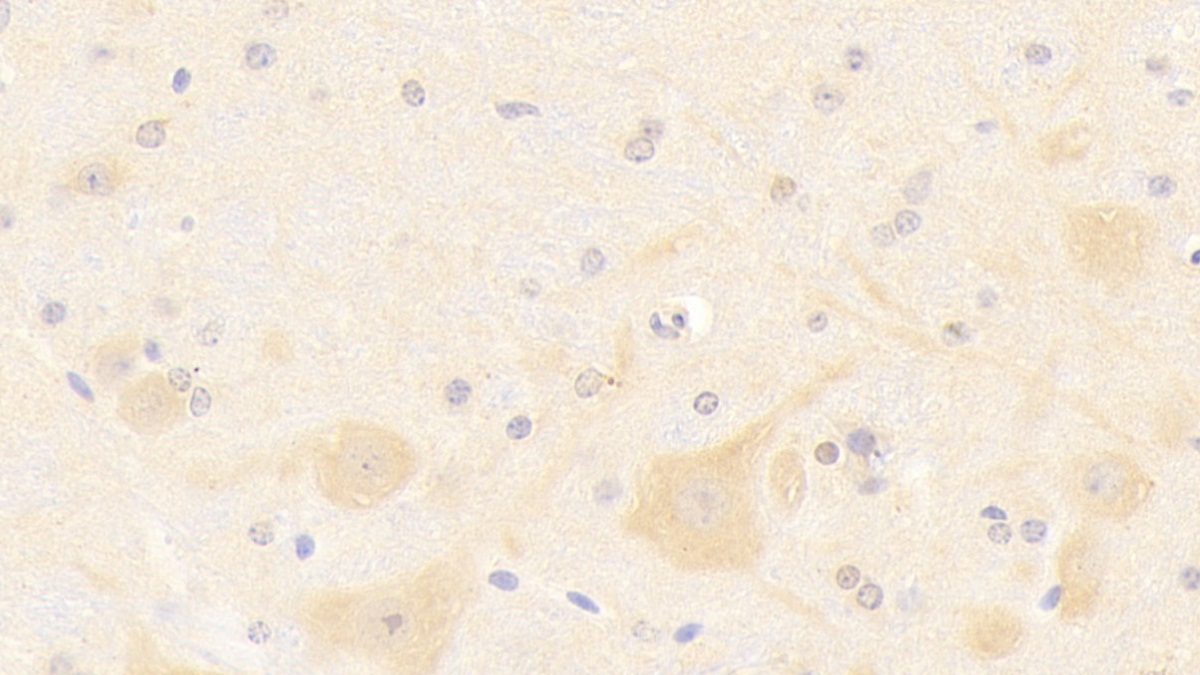 Polyclonal Antibody to Nitric Oxide Synthase 1, Neuronal (NOS1)