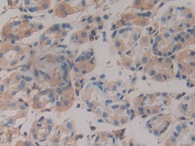 Polyclonal Antibody to Haptoglobin (Hpt)