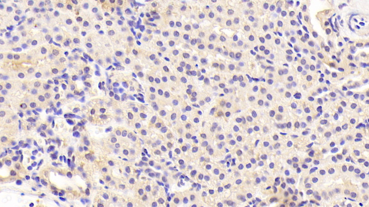 Polyclonal Antibody to Parathyroid Hormone Related Protein (PTHrP)