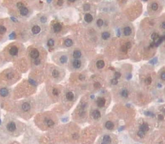 Polyclonal Antibody to Parathyroid Hormone Related Protein (PTHrP)