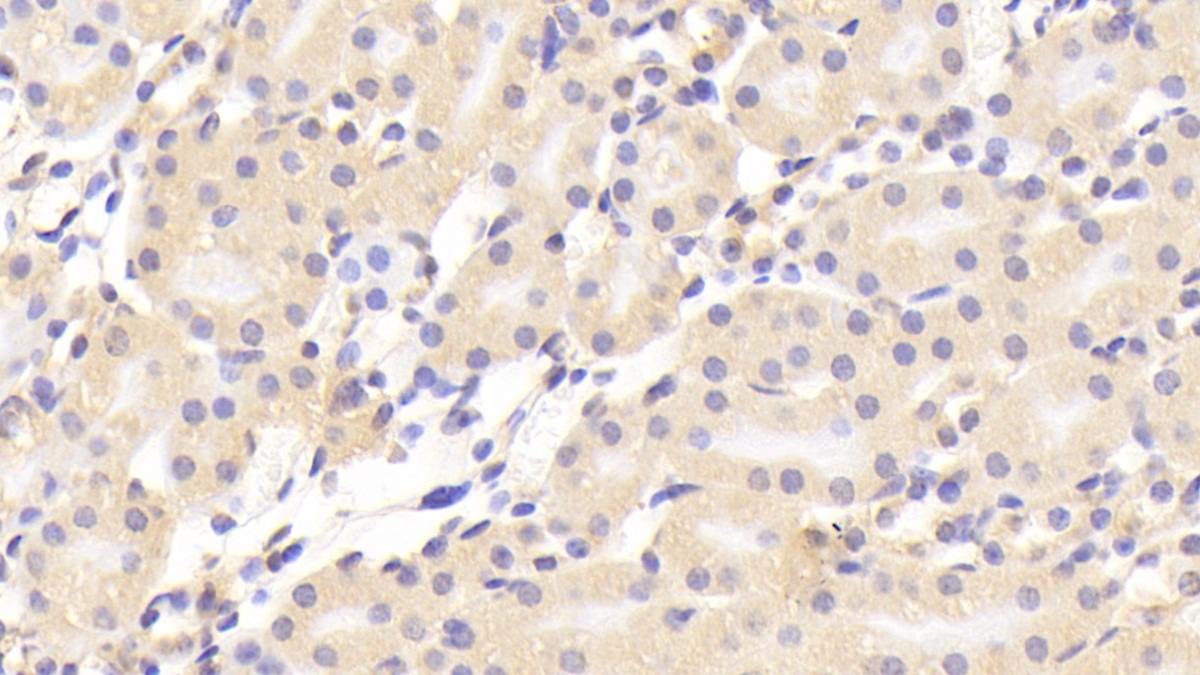 Polyclonal Antibody to Coagulation Factor II (F2)