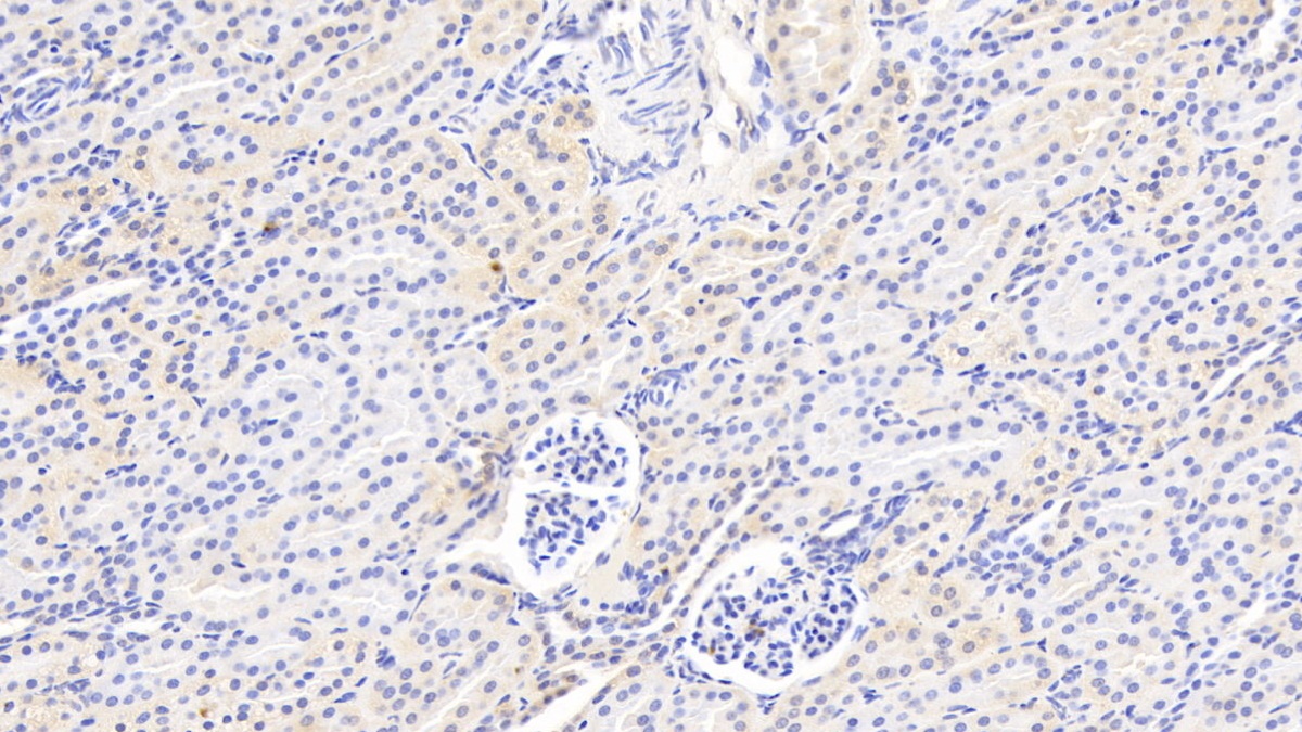 Polyclonal Antibody to Coagulation Factor II (F2)