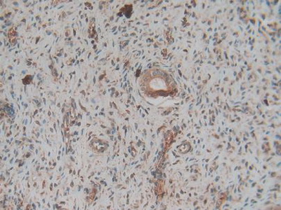 Polyclonal Antibody to Coagulation Factor II (F2)