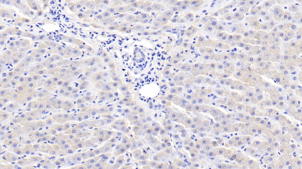 Polyclonal Antibody to C Reactive Protein (CRP)