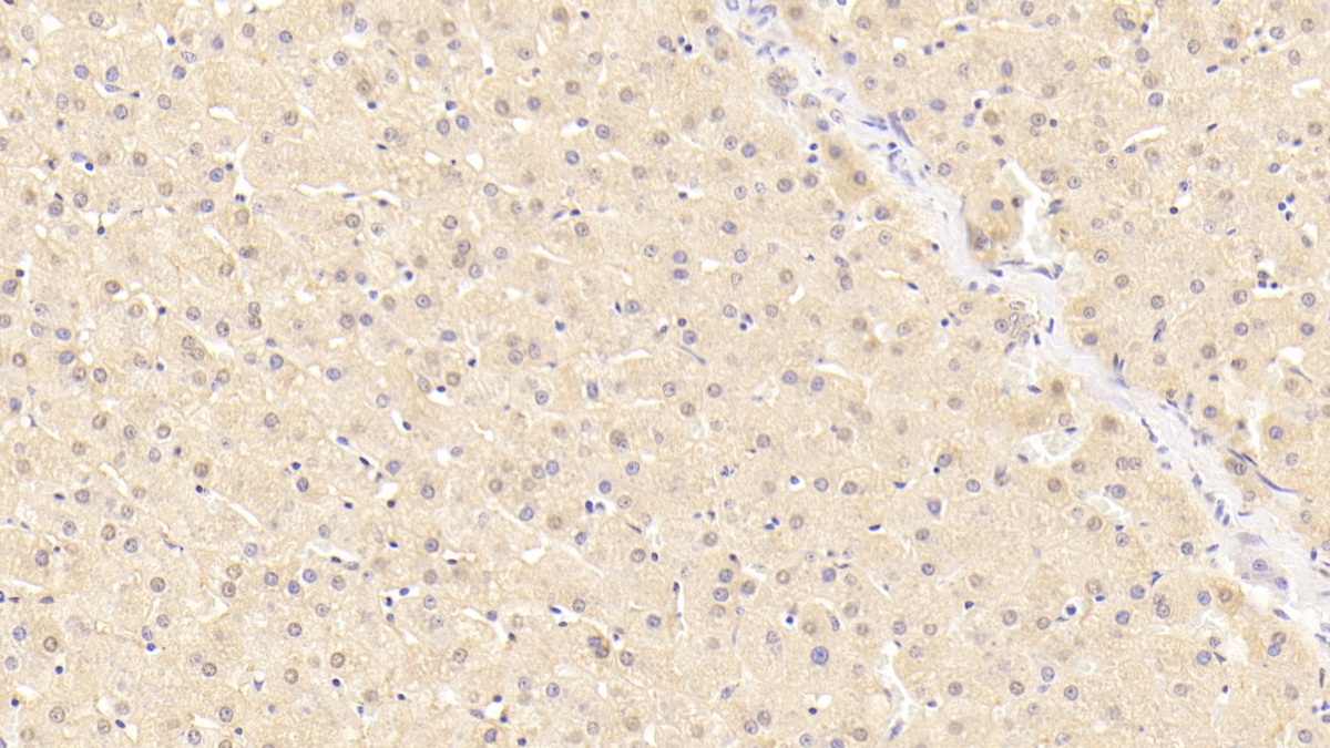 Polyclonal Antibody to C Reactive Protein (CRP)